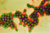 Polyoma viruses