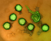 Rift Valley fever virus,TEM