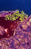Hantavirus bursting from a cell
