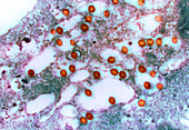 Rift Valley fever virus,TEM