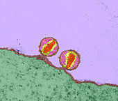 HIV viruses,TEM