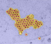 Polio viruses,TEM
