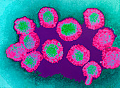 West Nile viruses,TEM