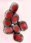 Vaccinia virus particles,TEM