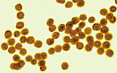 West Nile viruses,TEM