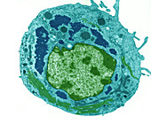 Reovirus particles in a cell,TEM