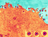 Herpes simplex viruses,TEM