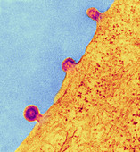 Herpes simplex viruses,TEM