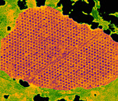 Human papilloma virus particles,TEM