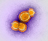 H5N1 avian influenza virus particles,TEM