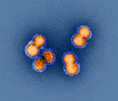 H5N1 avian influenza virus particles,TEM