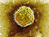 Mumps virus,TEM