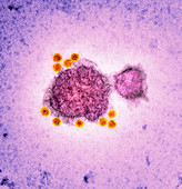 Parvovirus particles,TEM