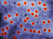 Papillomavirus virions,TEM