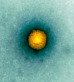 Herpes virus particle,TEM