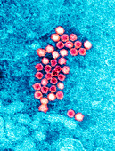 Human bocavirus,TEM