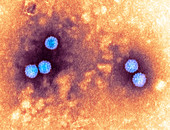 Polyoma virus particles,TEM