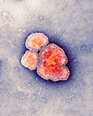 Measles virus particles,TEM