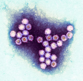 Norovirus particles,TEM