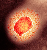 Monkeypox virus particle,TEM