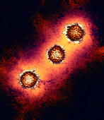 Herpes simplex virus particles,TEM