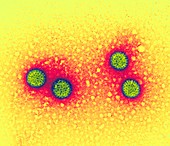 Rotavirus particles,TEM