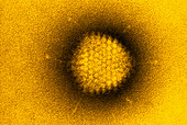 Tinted TEM of adenovirus