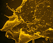 Tinted SEM of human coronaviruses on cell surface