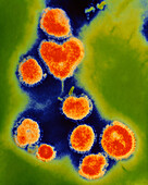 Coloured TEM of Beijing influenza viruses