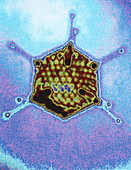 Computer graphic image of an adenovirus particle