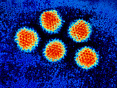 Coloured TEM of adenoviruses