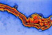Coloured TEM of influenza C viruses