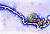 Coloured TEM of influenza C viruses