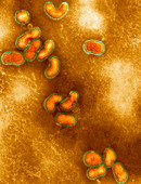 Avian influenza virus,TEM