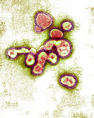 Avian influenza virus,TEM