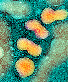 H5N1 avian influenza virus particles,TEM