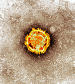 SARS virus,TEM