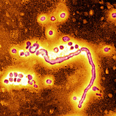 Influenzavirus A,TEM