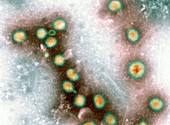 Avian influenza virus particles,TEM