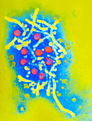 Coloured TEM of hepatitis B virus & its antigen