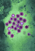Hepatitis B viruses