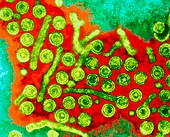 Hepatitis B viruses,TEM