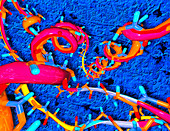 Computer artwork of part of a prion protein