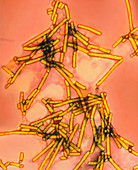 Coloured TEM of Tobacco Mosaic Viruses (TMV)