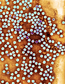 Cowpea mosaic virus,TEM