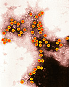 Carnation mottle virus,TEM