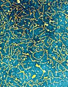 Maize yellow stripe virus,TEM