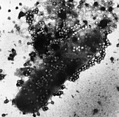 TEM of bacterial lysis by T4 phage infection