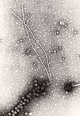 TEM of bacteriophages f1 & f2 on pilus of E. coli