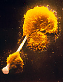 False-col SEM of macrophage pierced by asbestos